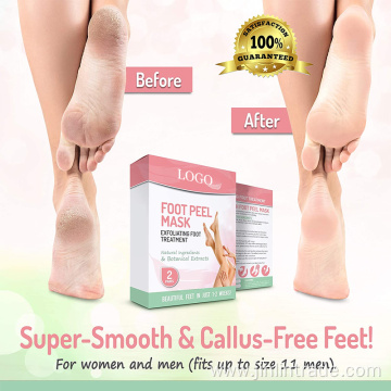 peeling foot treatment exfoliating foot mask peeling